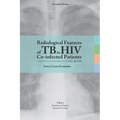 Radiological features of TB in HIV Co-infected Patients. Case book