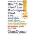What to Do about Your Brain-Injured Child: Or Your Brain-Damaged, Mentally Retarded, Mentally Deficient, Cerebral-Palsied, Epileptic, Autistic, Atheto
