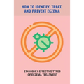How To Identify, Treat, And Prevent Eczema: 294 Highly Effective Types Of Eczema Treatment: How To Cure Eczema Fast