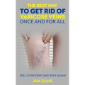 The Best Way to Get Rid of Varicose Veins Once and For All: Feel Confident and Sexy Again: Feel confident and sexy again