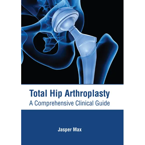 Total Hip Arthroplasty: A Comprehensive Clinical Guide