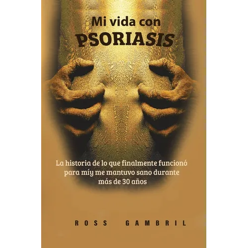 Mi vida con PSORIASIS