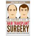 The Consumer's Guide to Hair Transplant Surgery: Everything You Wanted to Know About Hair Transplantation