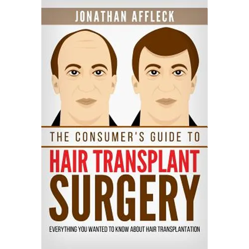 The Consumer's Guide to Hair Transplant Surgery: Everything You Wanted to Know About Hair Transplantation