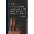 Moles, or Birth-marks, and Their Signification to Man and Woman
