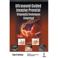 Ultrasound Guided Invasive Prenatal Diagnostic Techniques Simplified