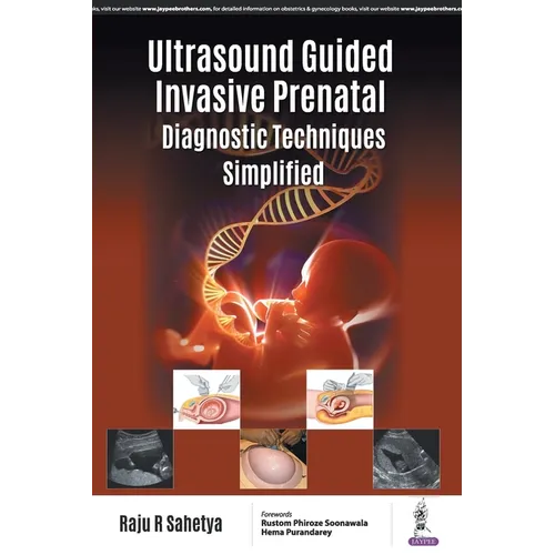 Ultrasound Guided Invasive Prenatal Diagnostic Techniques Simplified