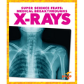 X-Rays
