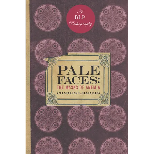 Pale Faces: The Masks of Anemia