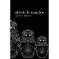 Stretch Marks
