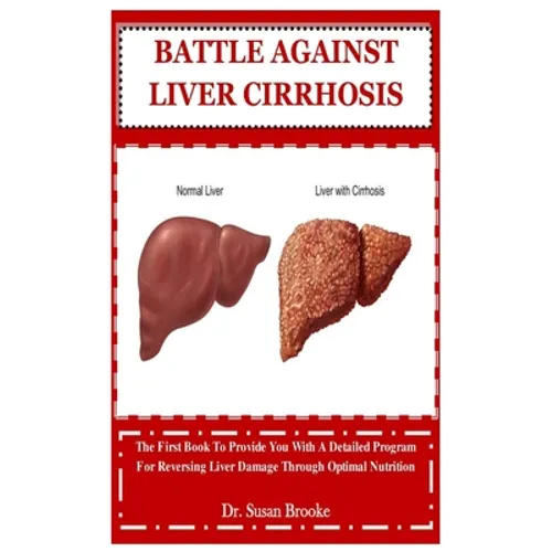 Battle Against Liver Cirrhosis: The First Book To Provide You With A Detailed Program For Reversing Liver Damage Through Optimal Nutrition