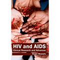 HIV and Aids: Clinical Research and Advances