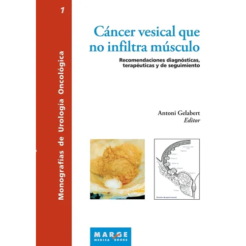 Cáncer vesical que no infiltra músculo: Recomendaciones diagnósticas, terapéuticas y de seguimiento