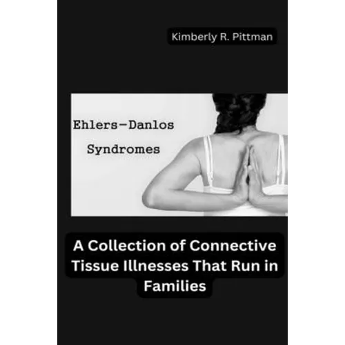 Ehlers-Danlos Syndrome: A Collection of Connective Tissue Illnesses That Run in Families