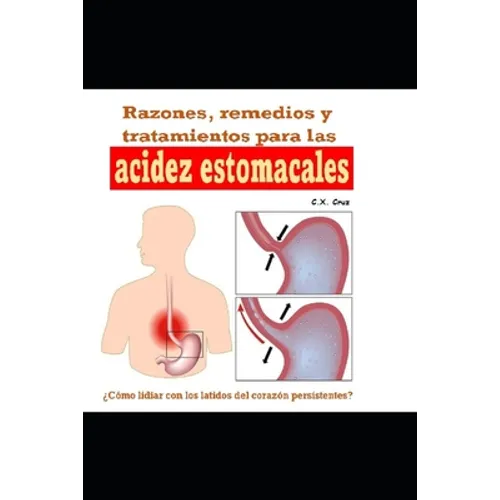 Razones, remedios y tratamientos para las acidez estomacales: ¿Cómo lidiar con los latidos del corazón persistentes?