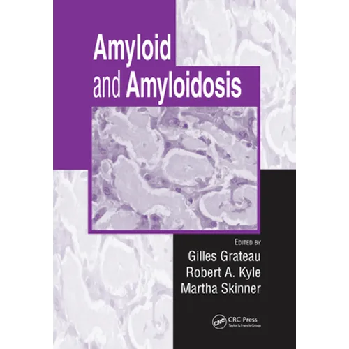 Amyloid and Amyloidosis