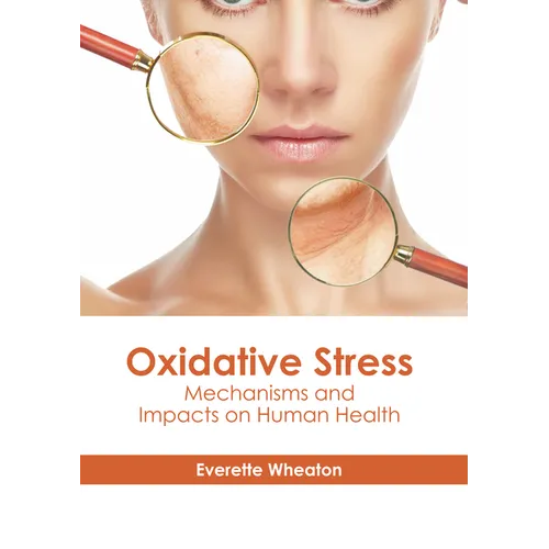 Oxidative Stress: Mechanisms and Impacts on Human Health