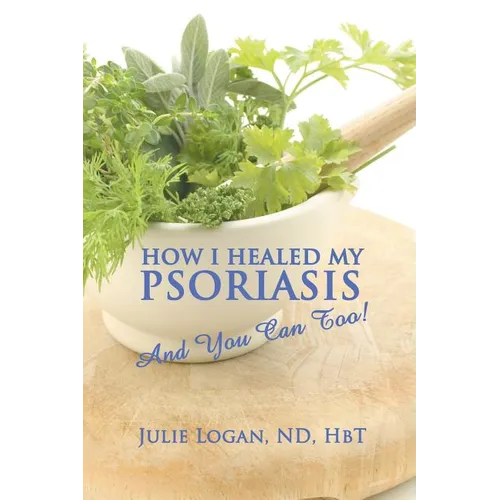 How I Healed My Psoriasis: And You Can Too!