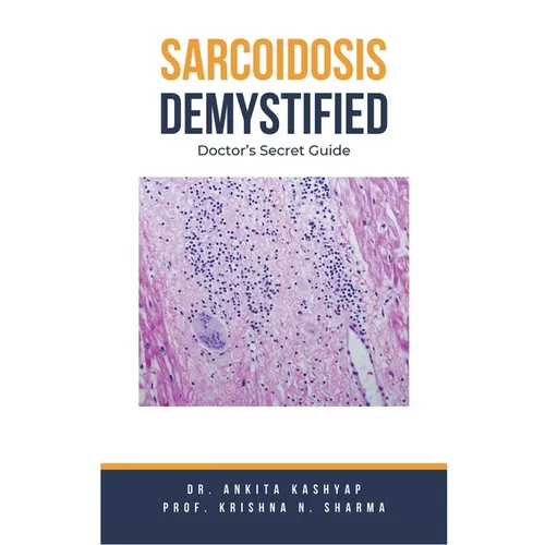 Sarcoidosis Demystified: Doctor's Secret Guide